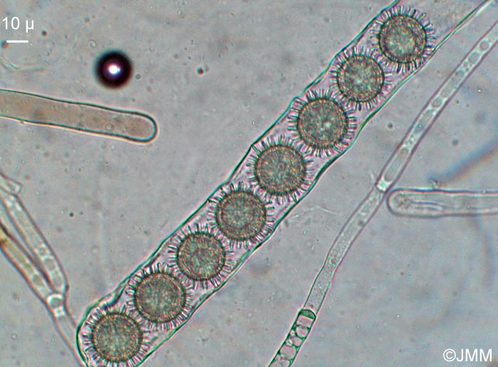 Boudiera tracheia : microscopie