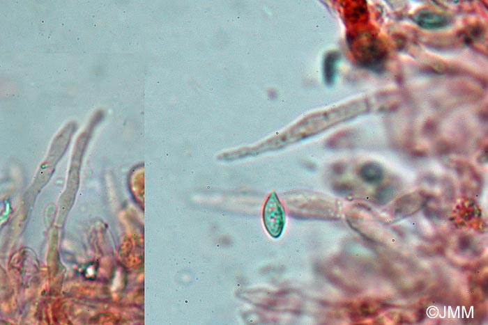 Clitopilus cystidiatus : microscopie - spore et cystides