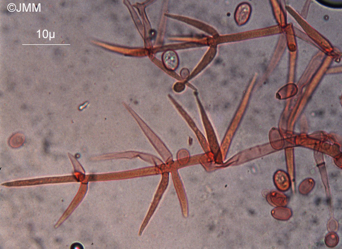 Calcarisporium arbuscula : conidiophores et conidies