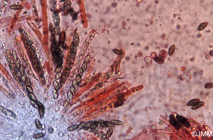 Helminthosphaeria clavariarum : asques et ascospores