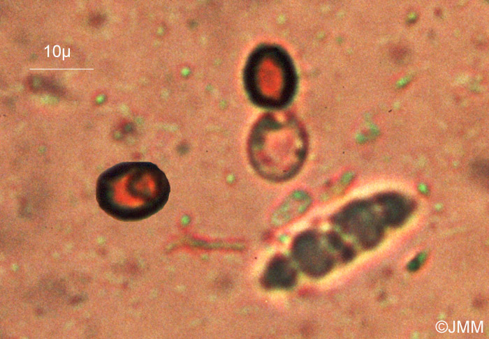 Melanospora fayodii = Microthecium fayodii : conidies subsphriques