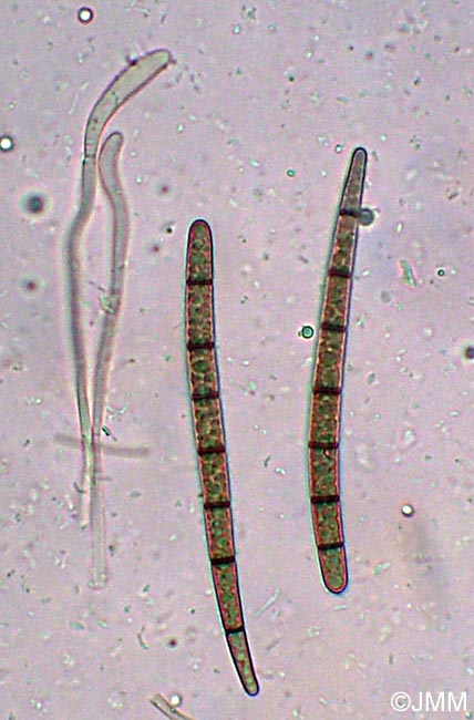 Geoglossum umbratile : microscopie