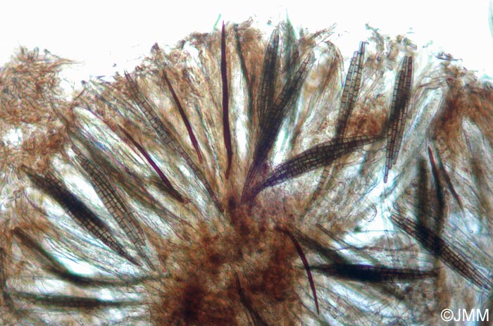 Trichoglossum variabile : poils ne dpassant l'hymnium