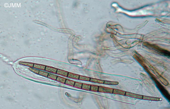 Trichoglossum variabile : spores de 7  14 cloisons