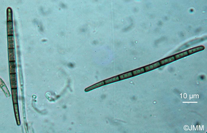Trichoglossum walteri : spores  7 cloisons