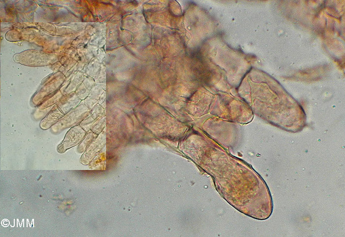 Morchella pseudoumbrina (= M. esculenta) : paraphyses renfles au sommet