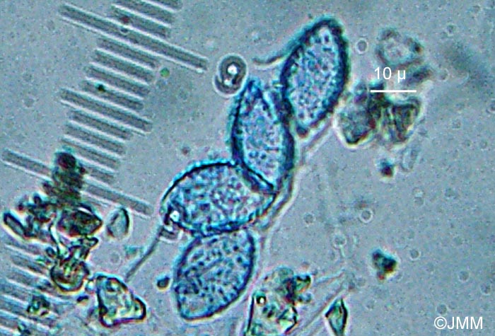 Octospora bridei : microscopie