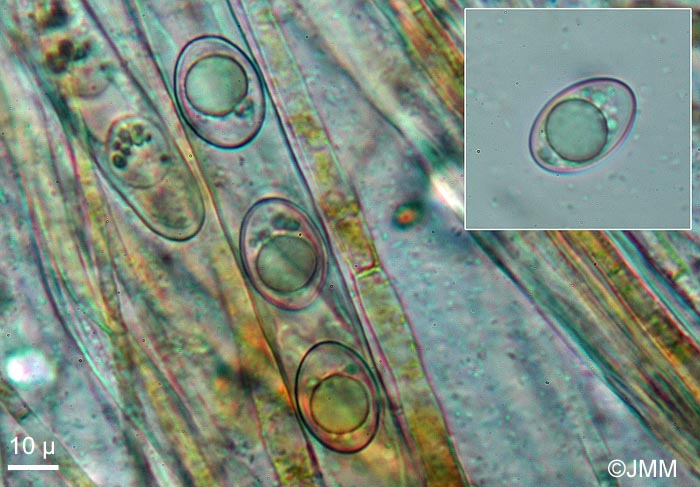 Octospora excipulata : microscopie