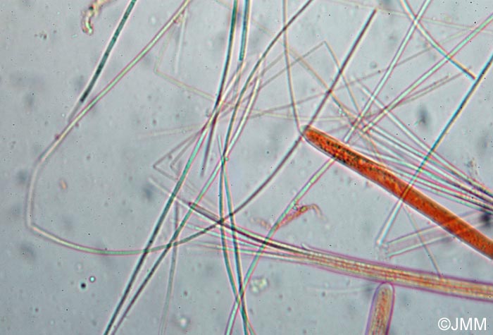 Vibrissea decolorans : asques et ascospores filiformes