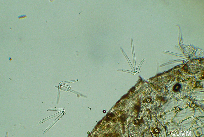 Utricularia bremii : Microscopie des poils de l'intrieur des utricules