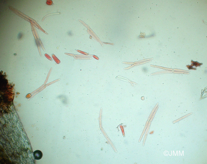 Utricularia intermedia : microscopie des poils de l'intrieur des utricules