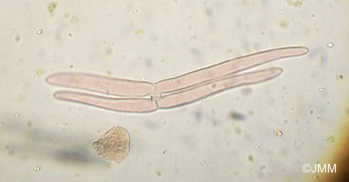 Utricularia intermedia : microscopie des poils de l'intrieur des utricules