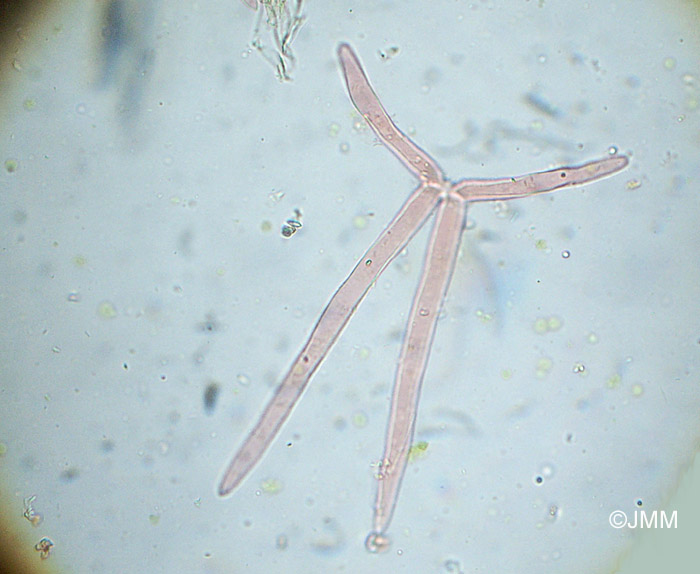 Utricularia ochroleuca : microscopie des poils de l'intrieur des utricules