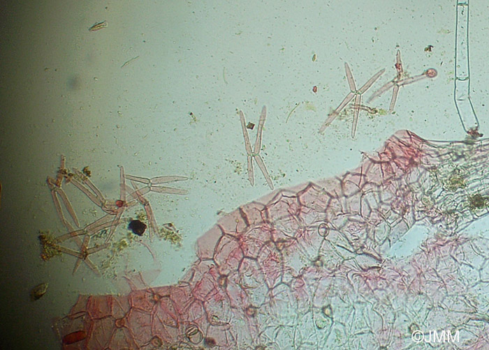 Utricularia stygia : microscopie des poils de l'intrieur des utricules