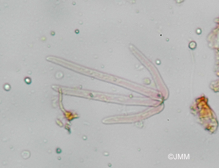 Utricularia minor : Microscopie des poils de l'intrieur des utricules
