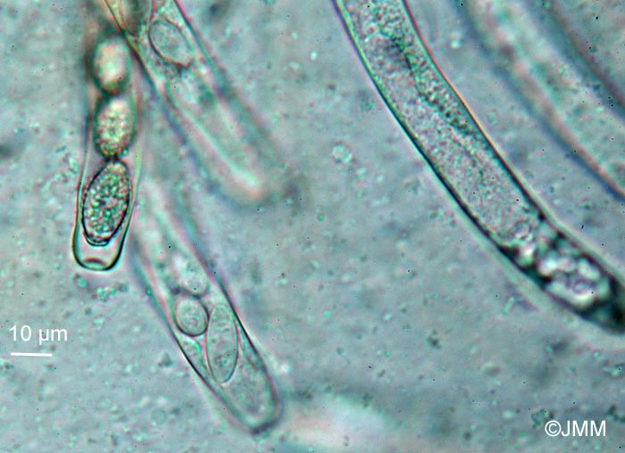 Gyromitra sp. : ascospores