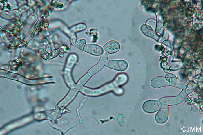 Botryobasidium medium : hyphes et spore