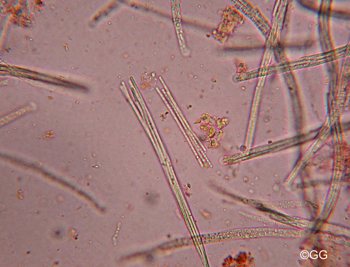 Ophiocordyceps superficialis : spores et asques