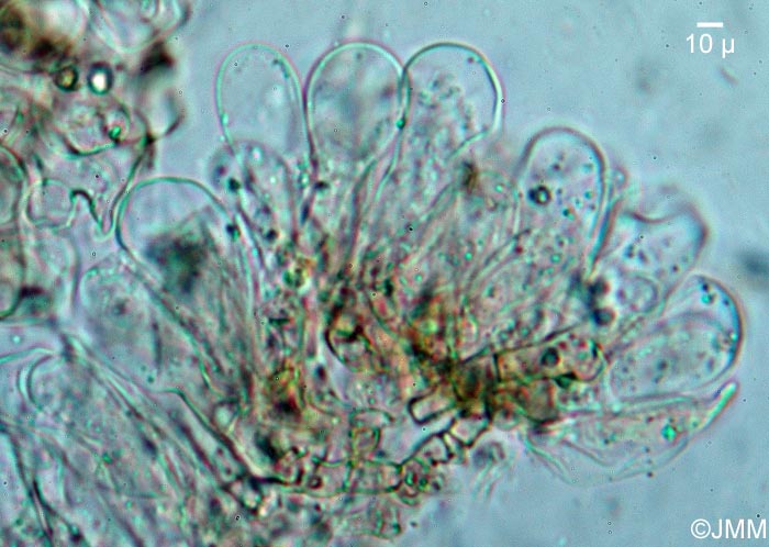 Coprinus schroeteri = Parasola schroeteri : cheilocystides