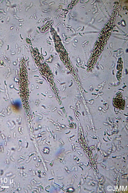 Diatrypella verruciformis : asques et ascospores