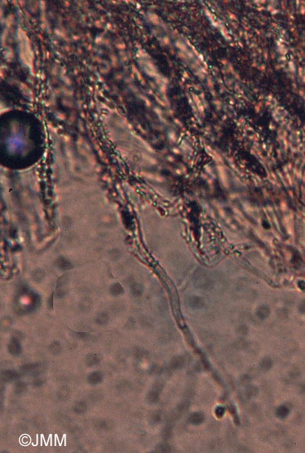 Flagelloscypha minutissima : poils de la marge en microscopie