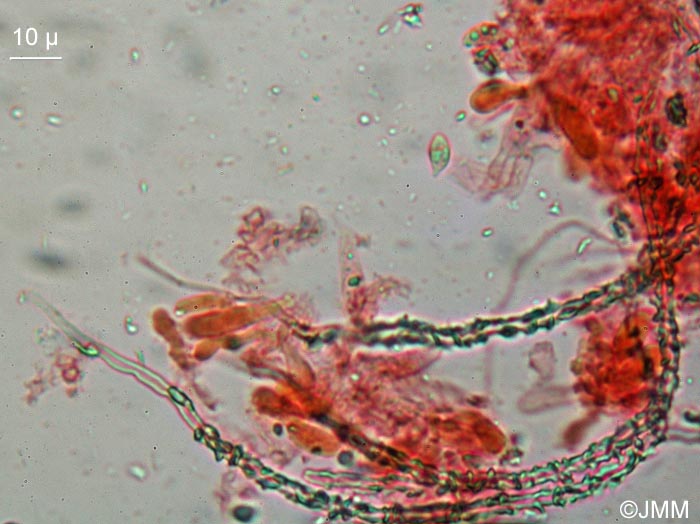 Flagelloscypha minutissima : microscopie