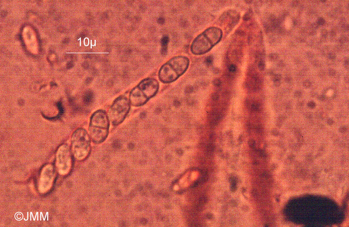 Cosmospora arxii : asques et ascospores