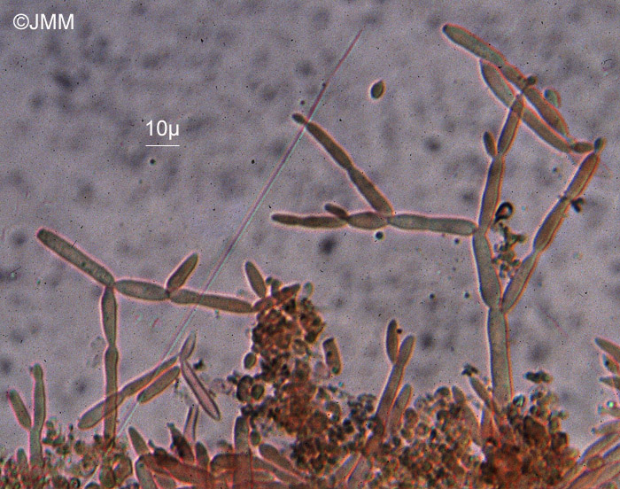 Heteroconium tetracoilum : conidiophores