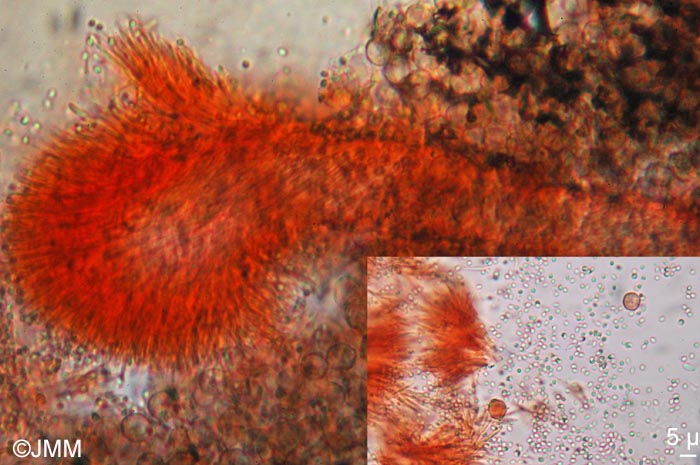 Stilbella tomentosa : microscopie