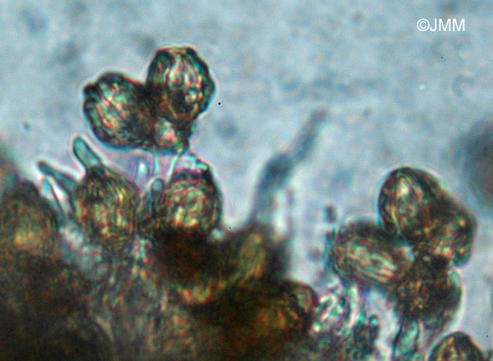 Gautiera morchellaeformis : spores et basides