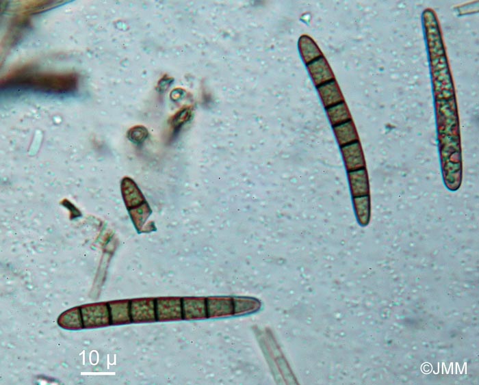 Geoglossum alpinum : spores