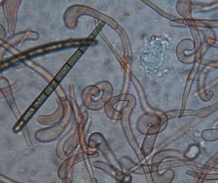 Geoglossum barlae : spores et paraphyses