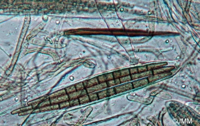 Trichoglossum variabile : poils et ascospores