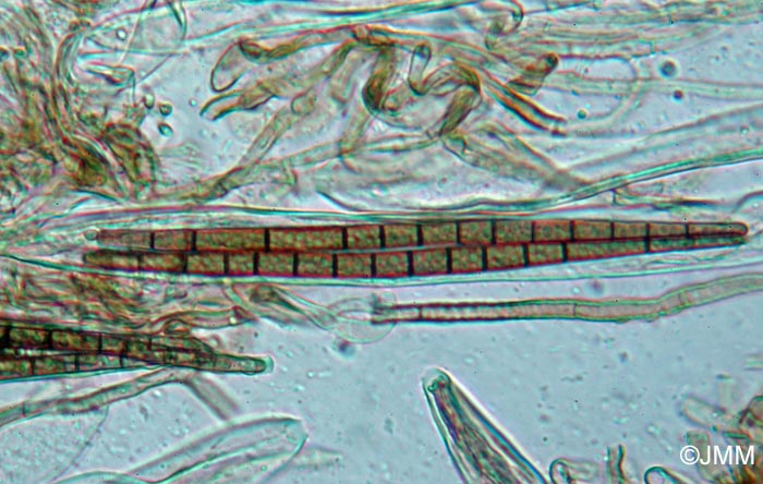 Trichoglossum variabile : ascospores