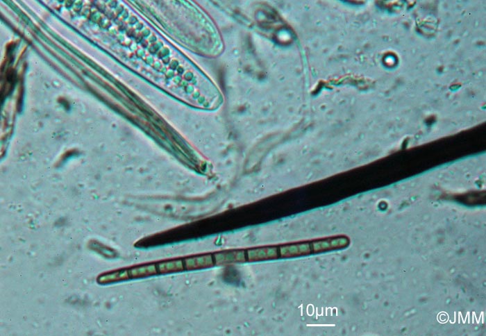 Trichoglossum walteri : spore à 7 cloisons et poil