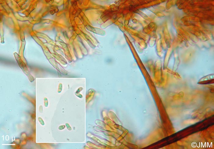 Hymenochaete cinnamomea : microscopie