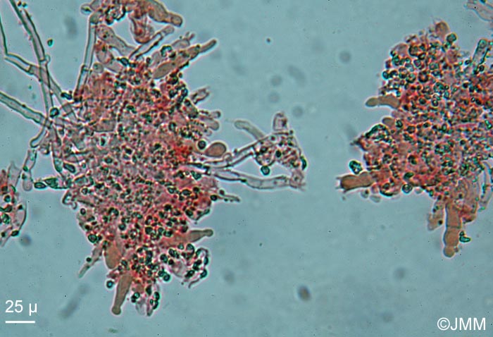 Hyphoderma sambuci : microscopie
