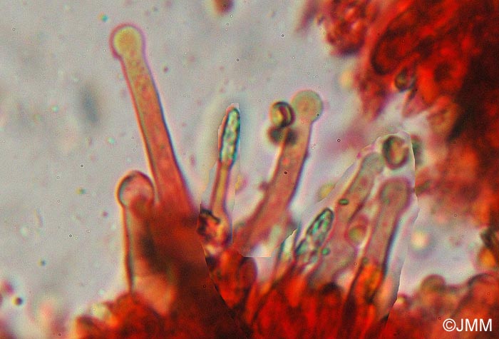 Hyphodontia alutaria : microscopie
