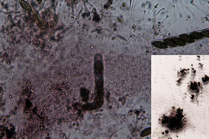 Hypoxylon vogesiacum : pigments gris-violet du stroma, solubles dans KOH