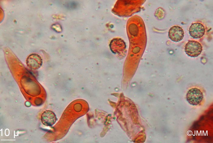 Laccaria macrocystidiata : microscopie