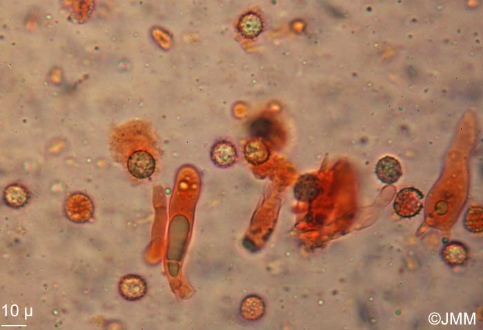 Laccaria macrocystidiata : microscopie