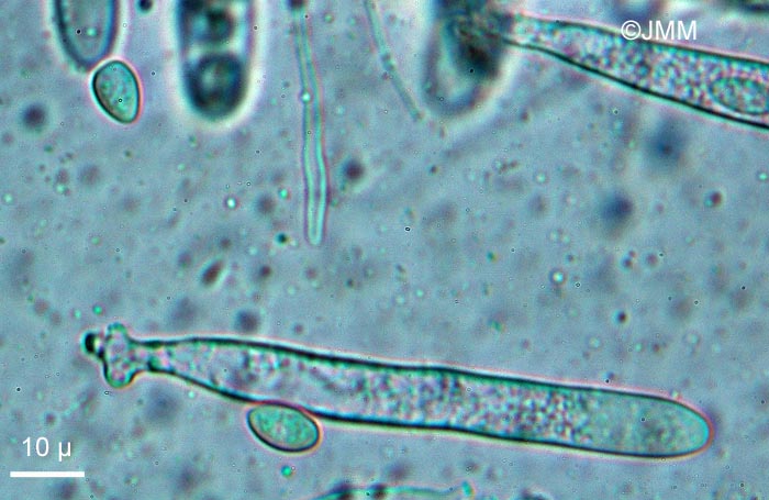 Lachnellula gallica : asques et spores