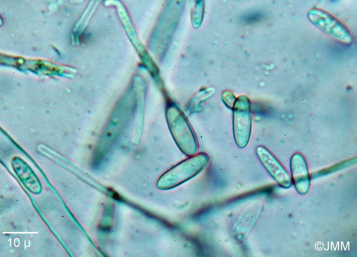 Lachnellula occidentalis : spores