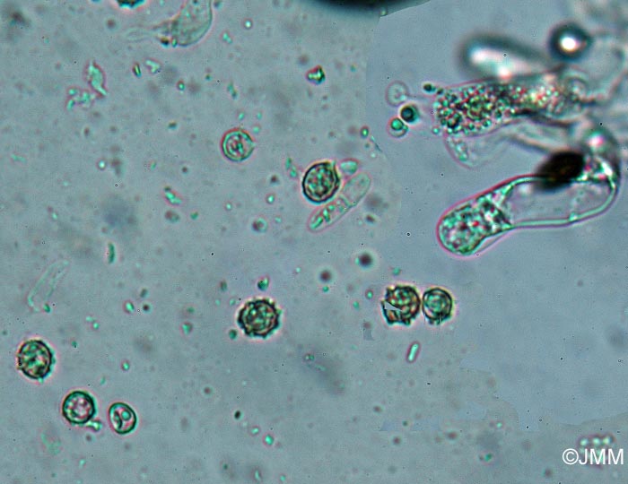 Lindtneria trachyspora : spores et basides