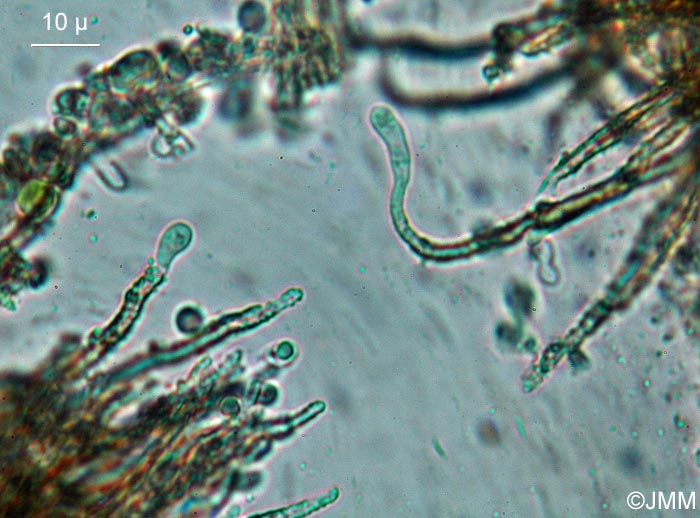 Merismodes anomala : microscopie