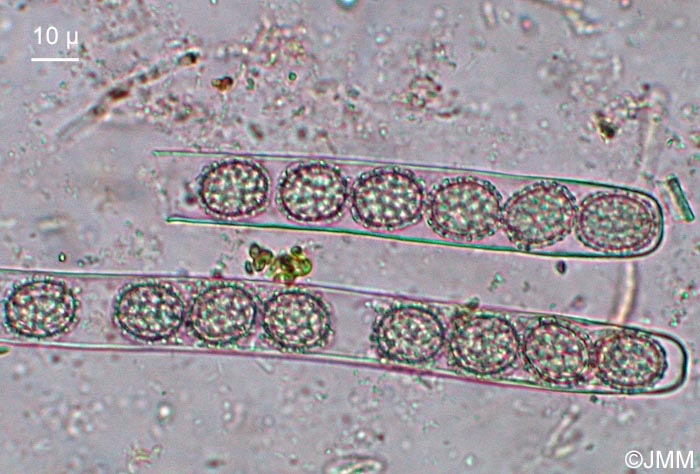 Moravecia calospora : microscopie