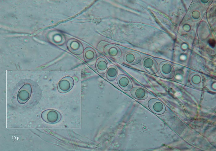 Neottiella hetieri : microscopie