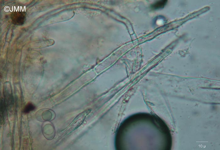 Neottiella hetieri : microscopie