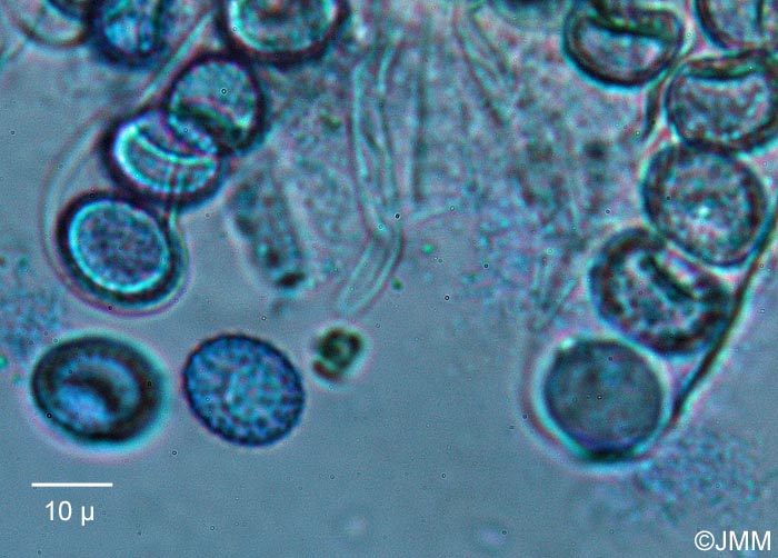 Octospora affinis : spores et asques