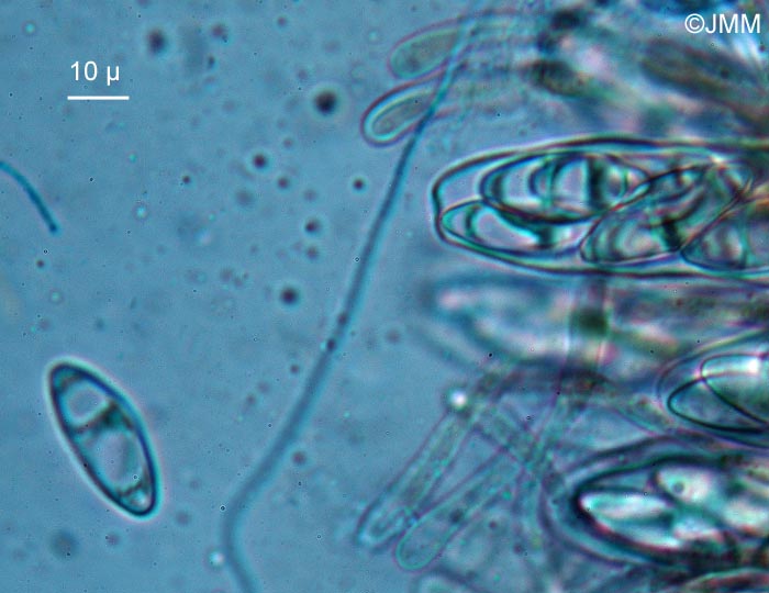 Octospora coccinea : microscopie